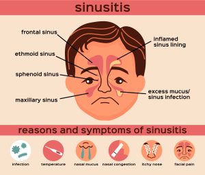 sinus, cold, allerhgies